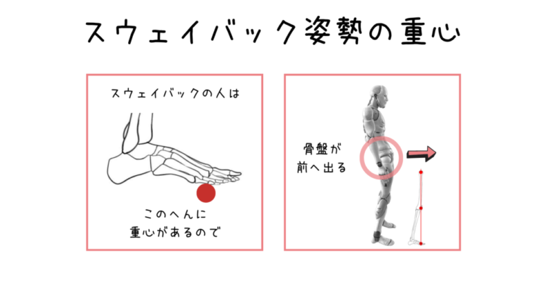 日本人に多いスウェイバック姿勢 うちだ整体院