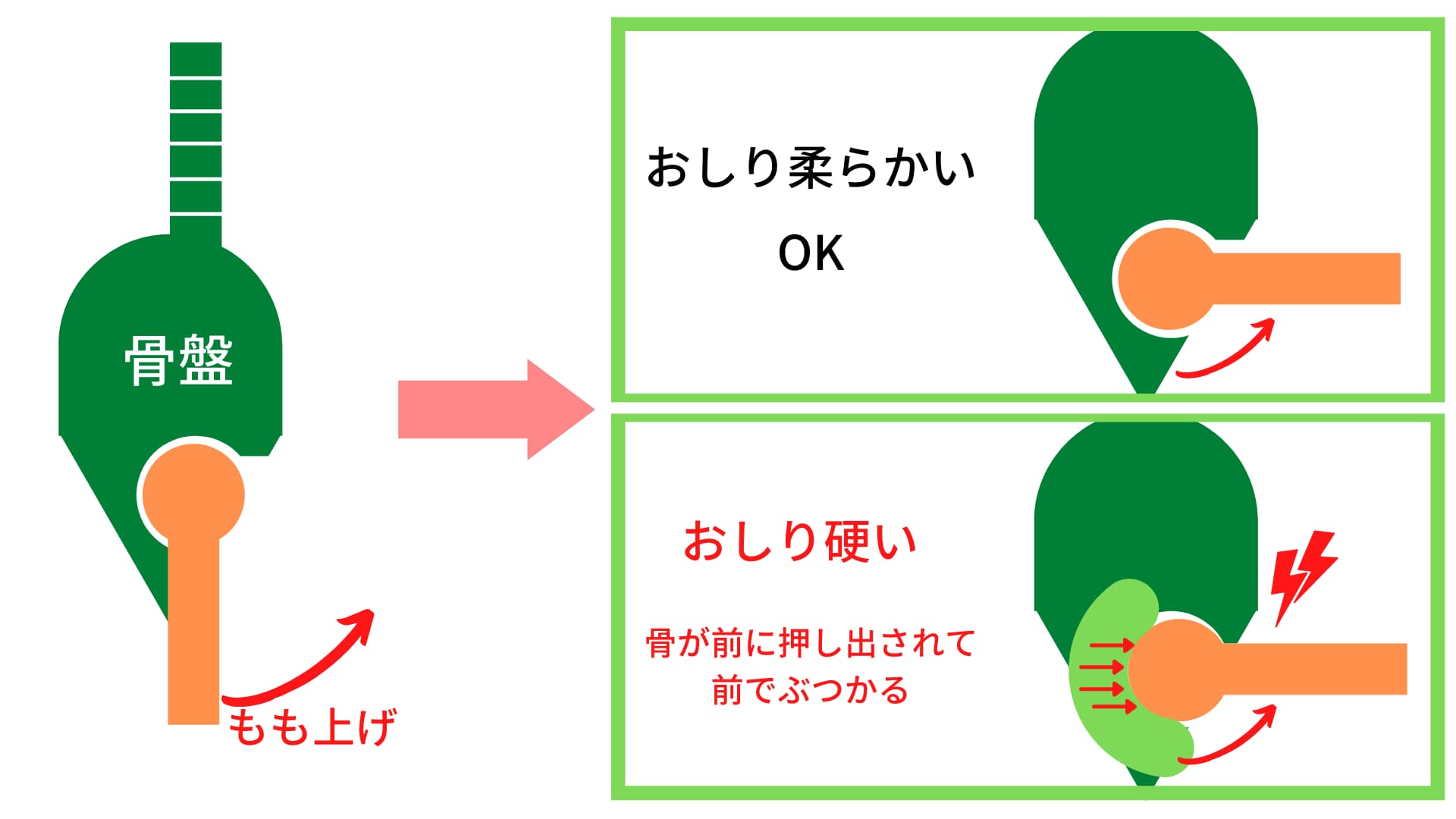 股関節のつまり感 うちだ整体院