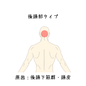 肩こりの原因は後頭下筋群・頭皮